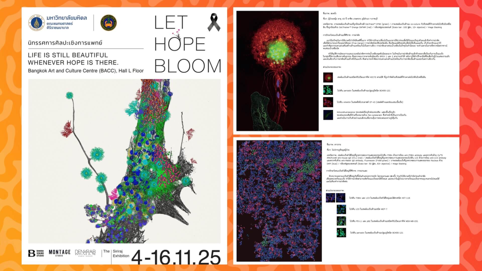 ศิริราช เชิญชมนิทรรศการศิลปะเชิงการแพทย์ Let Hope Bloom ช่วยเหลือผู้ป่วยโรคมะเร็ง